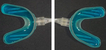Fluoroprofilassi
