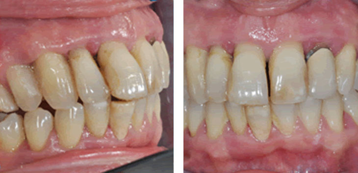 Interventi di chirurgia orale ed implantare