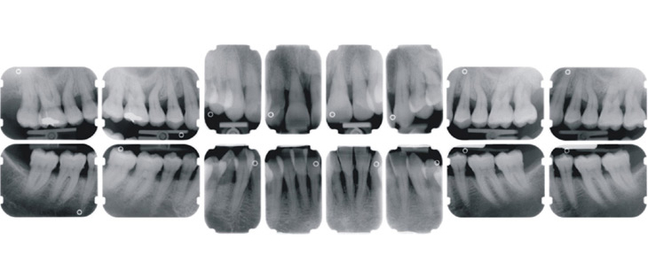 status radiografico