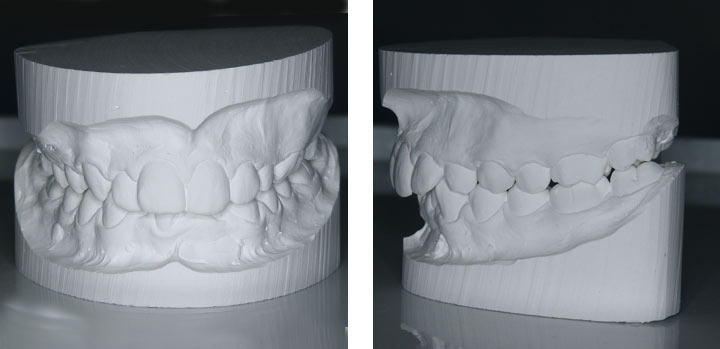 Studio del caso Ortodontico